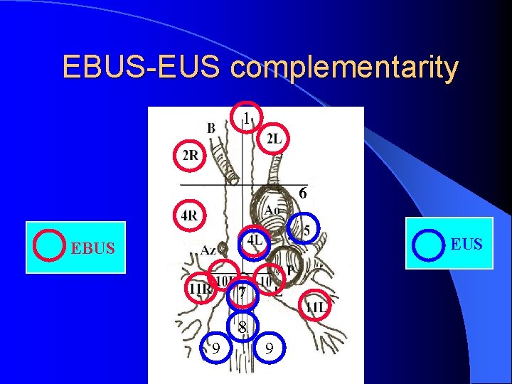 EBUS-EUS complementarity 1 6 EUS EBUS 7 8 9 9 