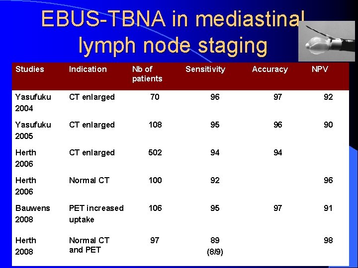 EBUS-TBNA in mediastinal lymph node staging Studies Indication Nb of patients Sensitivity Accuracy NPV