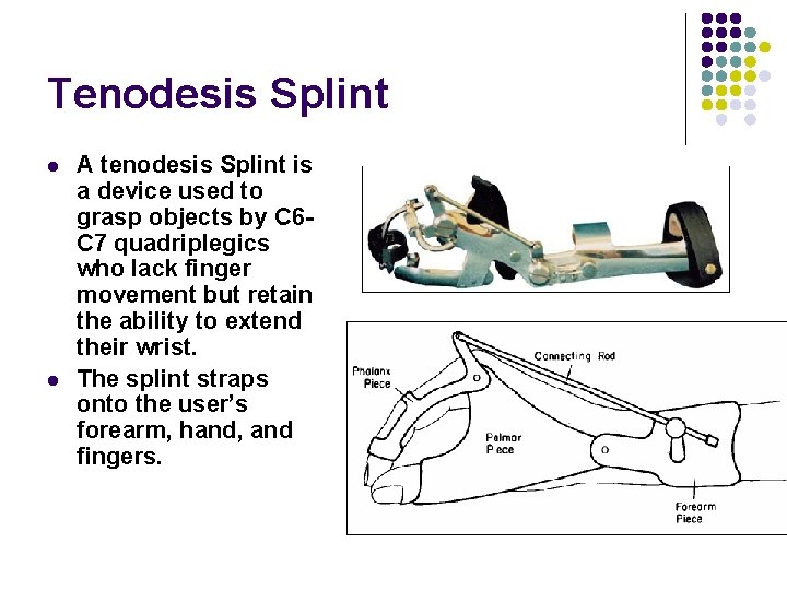 Tenodesis Splint l l A tenodesis Splint is a device used to grasp objects