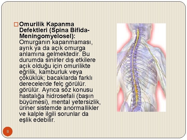 � Omurilik Kapanma Defektleri (Spina Bifida. Meningomyelosel): Omurganın kapanmaması, ayrık ya da açık omurga