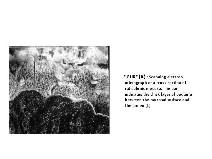 FIGURE (A) : Scanning electron micrograph of a cross-section of rat colonic mucosa. The