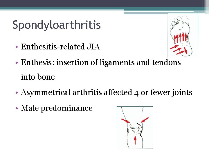 Spondyloarthritis • Enthesitis-related JIA • Enthesis: insertion of ligaments and tendons into bone •