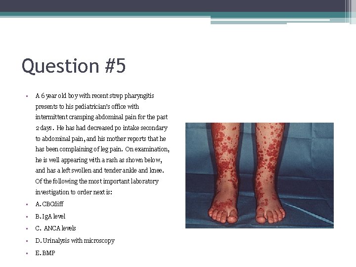 Question #5 • A 6 year old boy with recent strep pharyngitis presents to