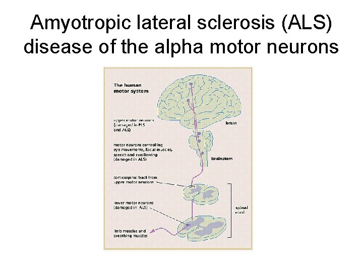Amyotropic lateral sclerosis (ALS) disease of the alpha motor neurons 