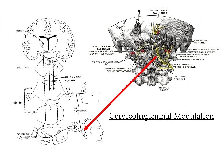 Cervicotrigeminal Modulation 