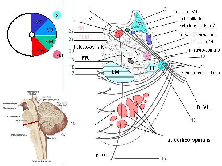 S SS ncl. o. n. VI ncl. solitarius V fld VS ncl. +tr. spinalis