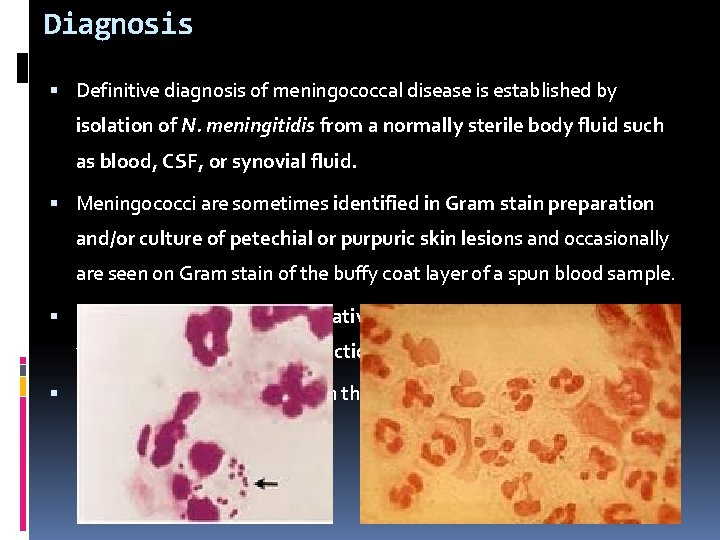Diagnosis Definitive diagnosis of meningococcal disease is established by isolation of N. meningitidis from