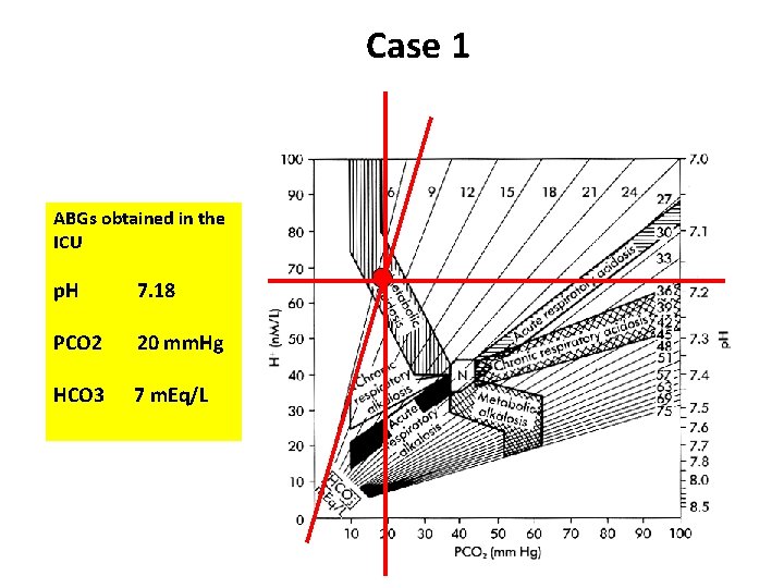Case 1 ABGs obtained in the ICU p. H 7. 18 PCO 2 20