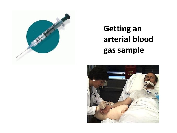 Getting an arterial blood gas sample 
