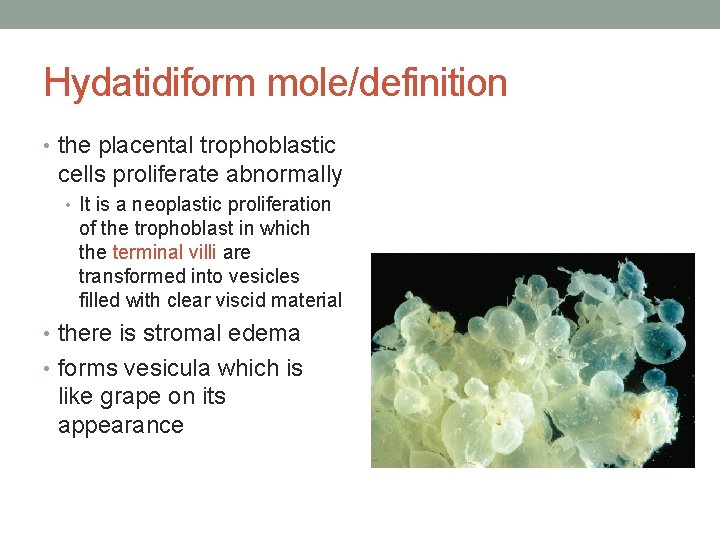 Hydatidiform mole/definition • the placental trophoblastic cells proliferate abnormally • It is a neoplastic