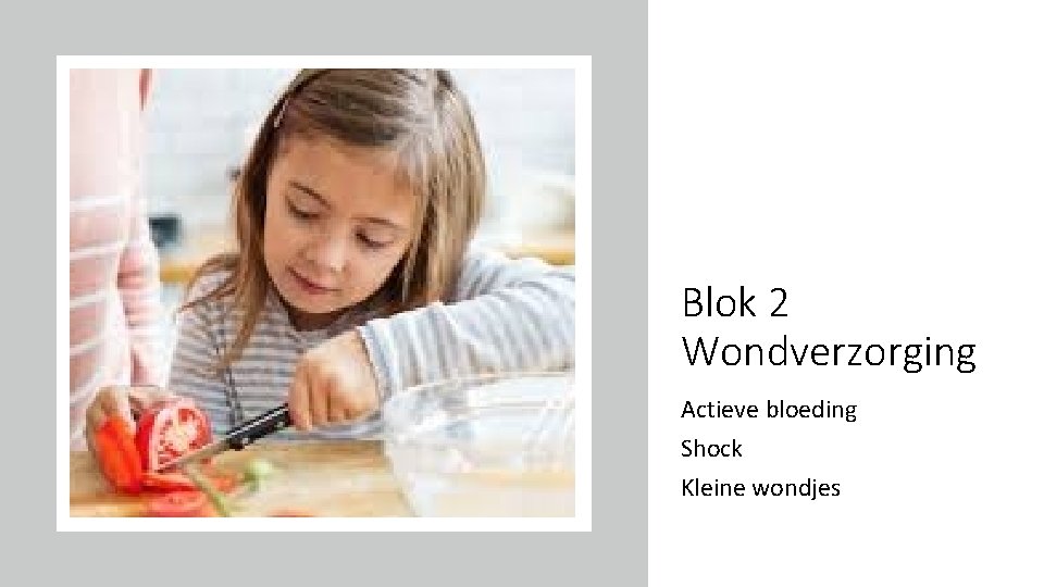 Blok 2 Wondverzorging Actieve bloeding Shock Kleine wondjes 