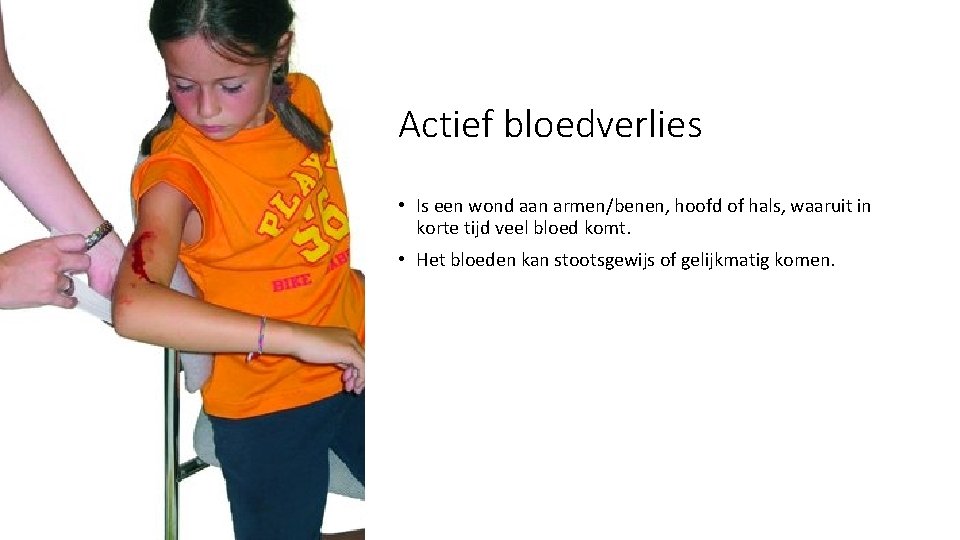 Actief bloedverlies • Is een wond aan armen/benen, hoofd of hals, waaruit in korte