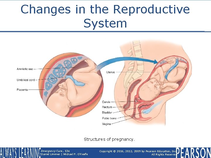Changes in the Reproductive System Structures of pregnancy. Emergency Care, 13 e Daniel Limmer