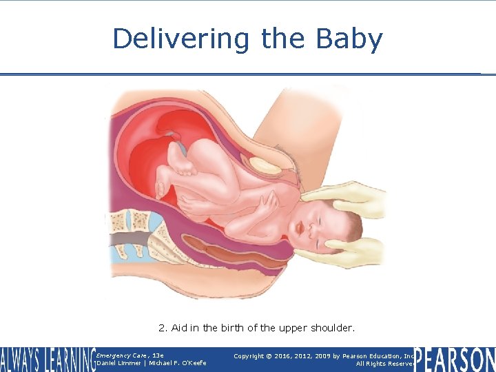 Delivering the Baby 2. Aid in the birth of the upper shoulder. Emergency Care,