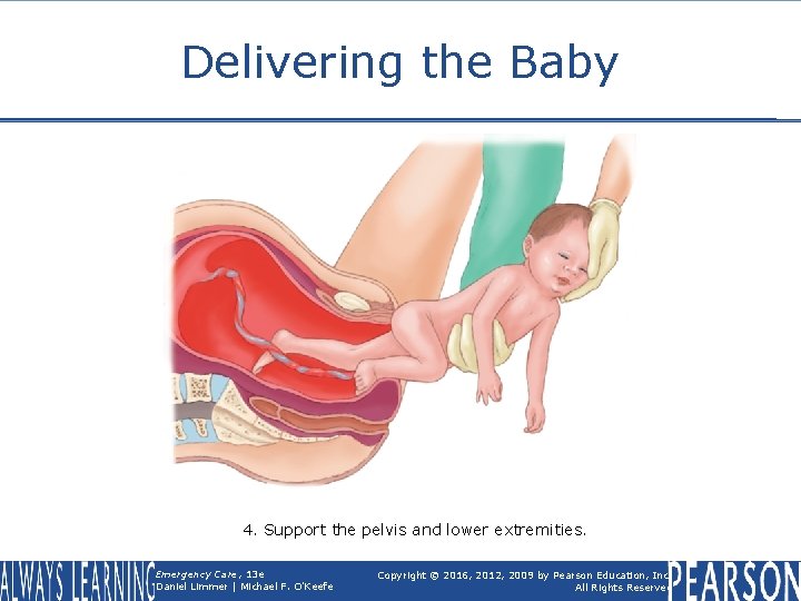 Delivering the Baby 4. Support the pelvis and lower extremities. Emergency Care, 13 e