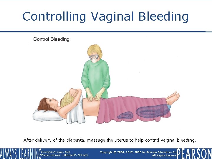 Controlling Vaginal Bleeding After delivery of the placenta, massage the uterus to help control