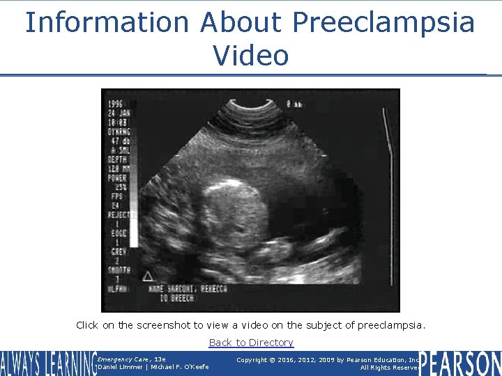 Information About Preeclampsia Video Click on the screenshot to view a video on the