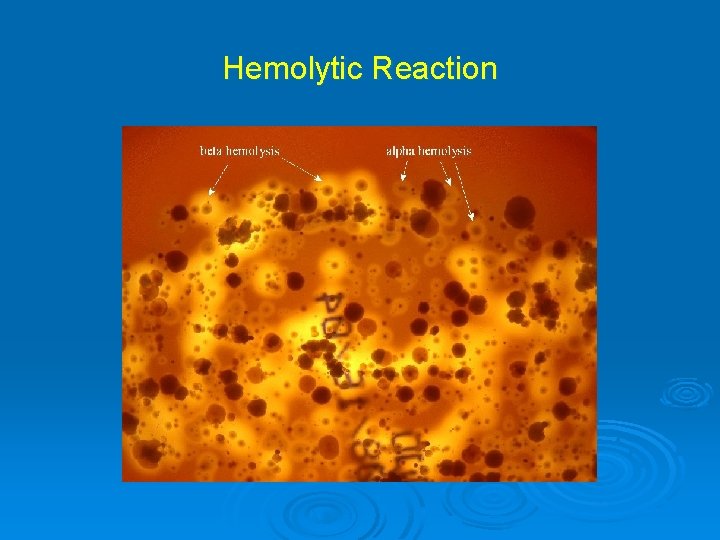 Hemolytic Reaction 