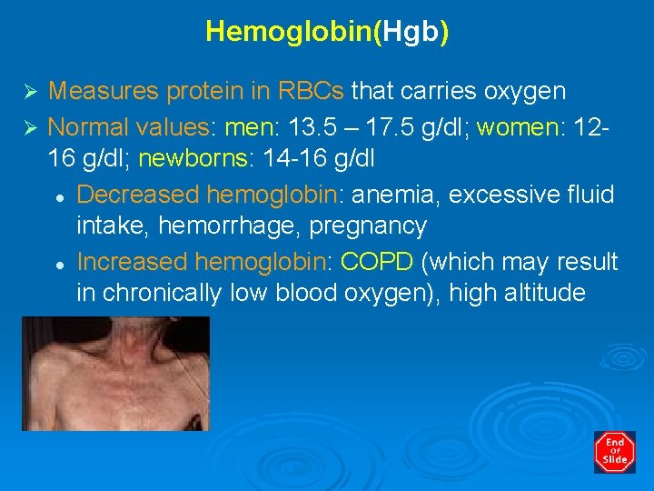 Hemoglobin(Hgb) Measures protein in RBCs that carries oxygen Ø Normal values: men: 13. 5
