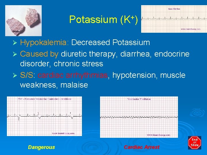 Potassium (K+) Hypokalemia: Decreased Potassium Ø Caused by diuretic therapy, diarrhea, endocrine disorder, chronic