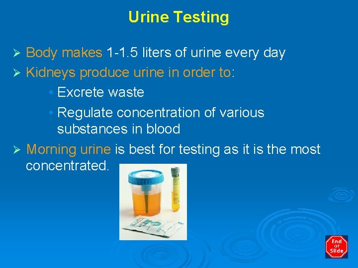 Urine Testing Body makes 1 -1. 5 liters of urine every day Ø Kidneys