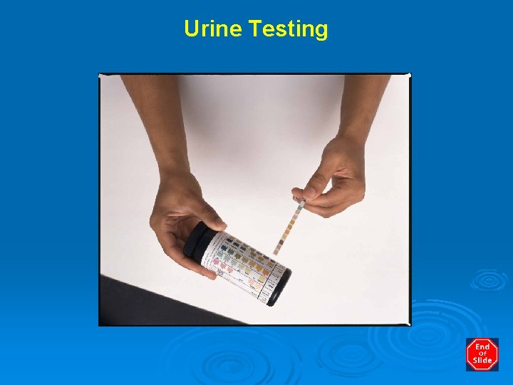 Urine Testing 