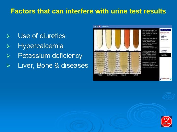 Factors that can interfere with urine test results Ø Ø Use of diuretics Hypercalcemia
