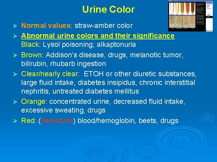 Urine Color Ø Ø Ø Normal values: straw-amber color Abnormal urine colors and their