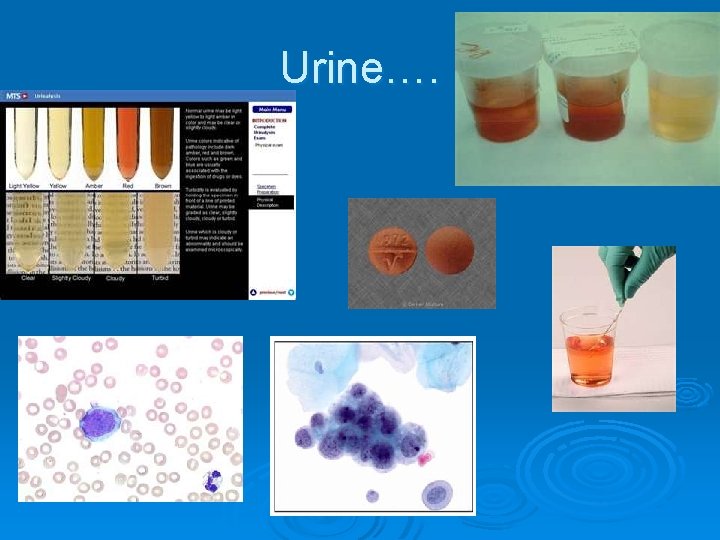 Urine…. 