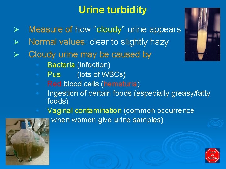 Urine turbidity Ø Ø Ø Measure of how “cloudy” urine appears Normal values: clear