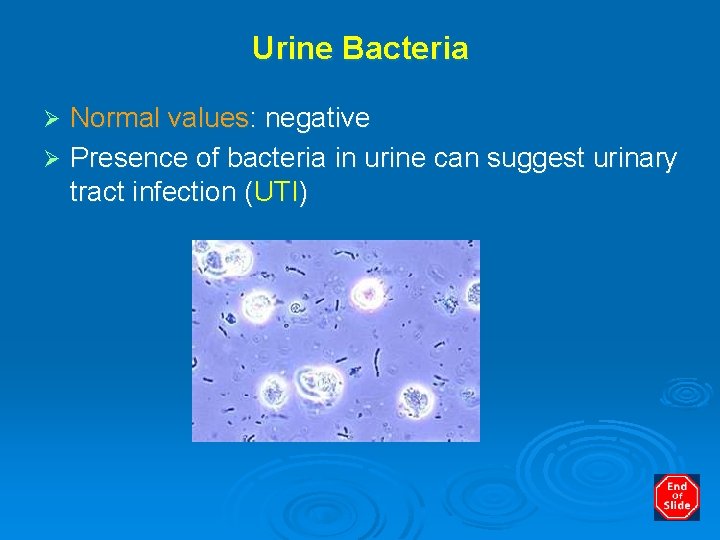 Urine Bacteria Normal values: negative Ø Presence of bacteria in urine can suggest urinary