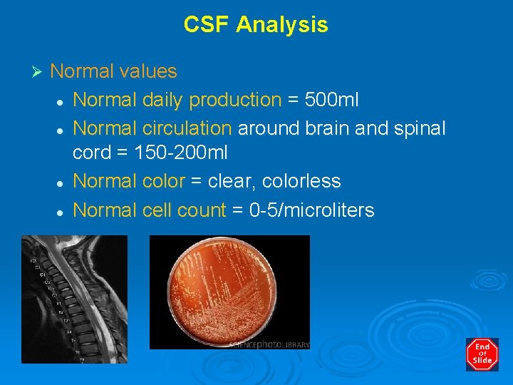 CSF Analysis Ø Normal values l Normal daily production = 500 ml l Normal