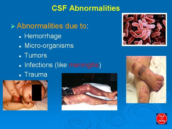 CSF Abnormalities Ø Abnormalities due to: l l l Hemorrhage Micro-organisms Tumors Infections (like