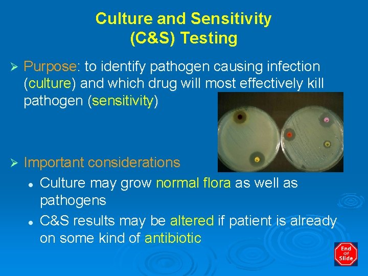 Culture and Sensitivity (C&S) Testing Ø Purpose: to identify pathogen causing infection (culture) and