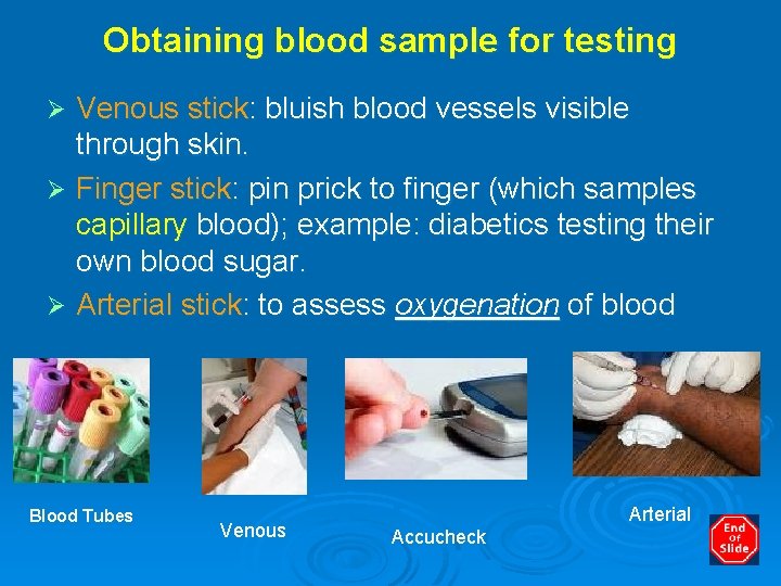 Obtaining blood sample for testing Venous stick: bluish blood vessels visible through skin. Ø