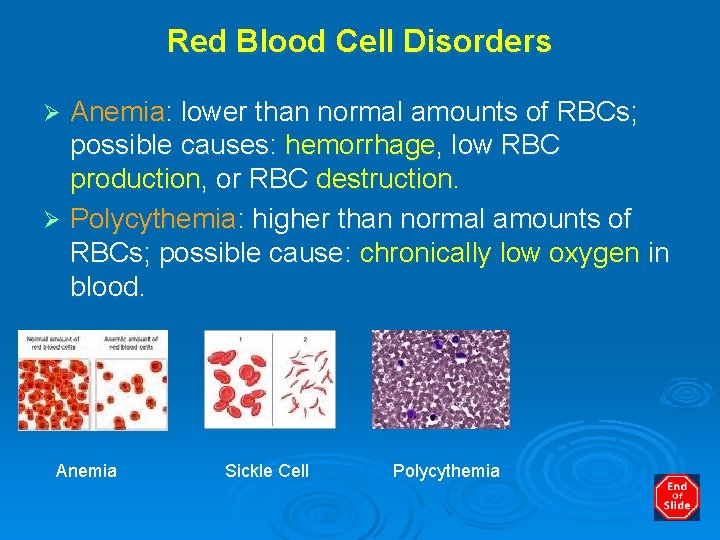 Red Blood Cell Disorders Anemia: lower than normal amounts of RBCs; possible causes: hemorrhage,