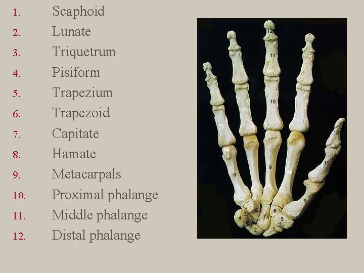 1. 2. 3. 4. 5. 6. 7. 8. 9. 10. 11. 12. Scaphoid Lunate