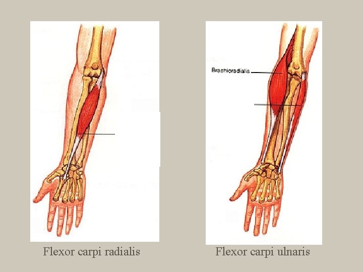 Flexor carpi radialis Flexor carpi ulnaris 