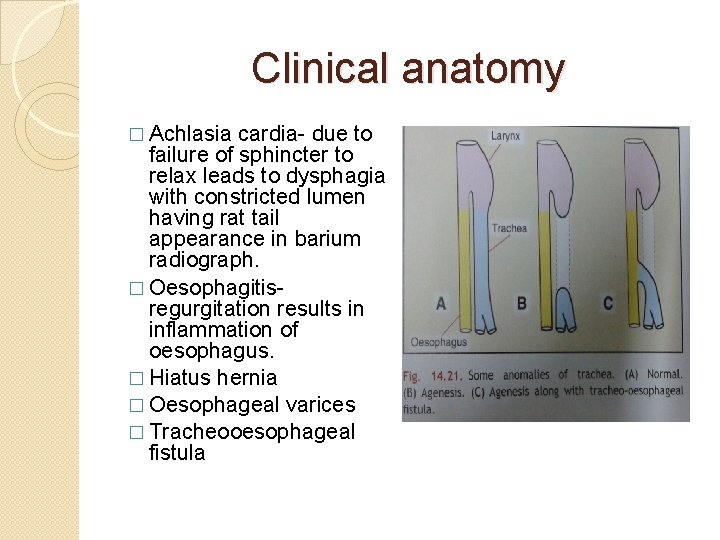 Clinical anatomy � Achlasia cardia- due to failure of sphincter to relax leads to