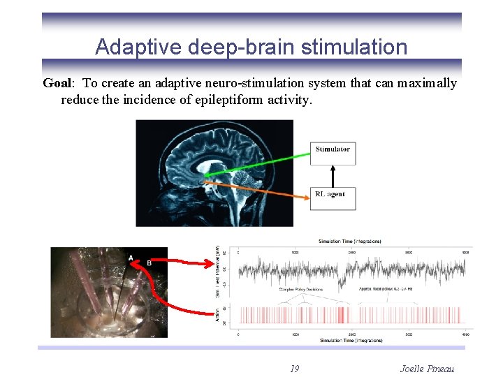 Adaptive deep-brain stimulation Goal: To create an adaptive neuro-stimulation system that can maximally reduce