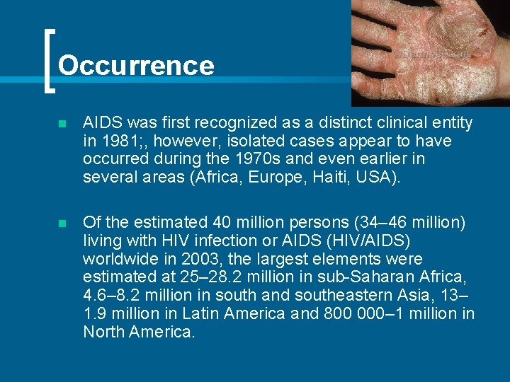 Occurrence n AIDS was first recognized as a distinct clinical entity in 1981; ,