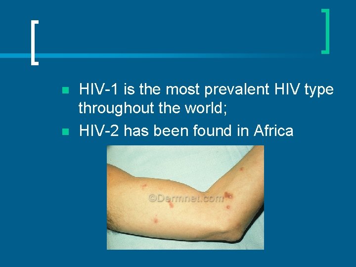 n n HIV-1 is the most prevalent HIV type throughout the world; HIV-2 has