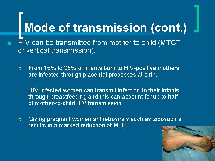 Mode of transmission (cont. ) n HIV can be transmitted from mother to child