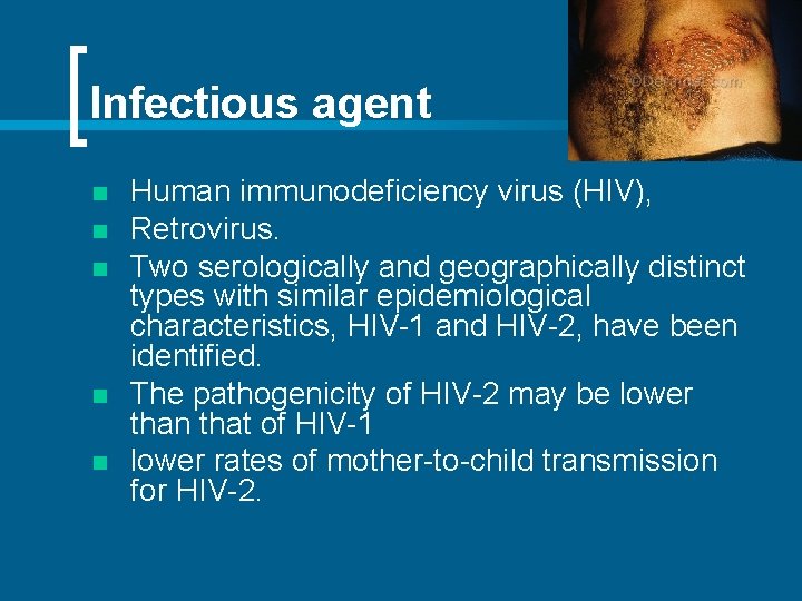 Infectious agent n n n Human immunodeficiency virus (HIV), Retrovirus. Two serologically and geographically