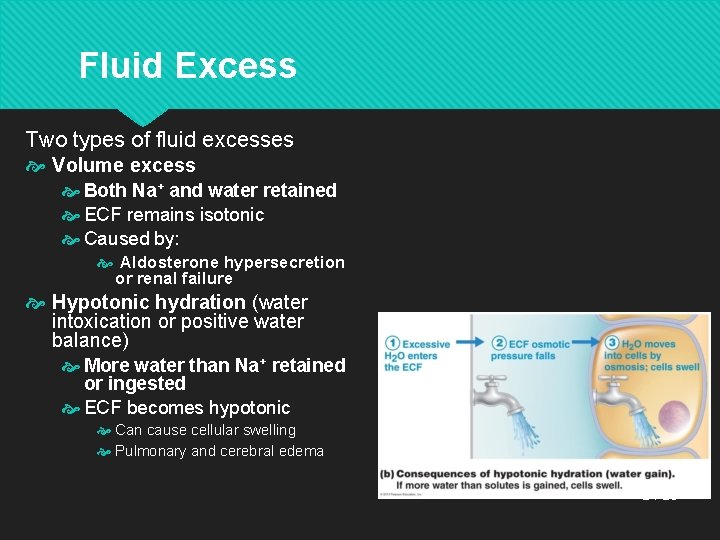 Fluid Excess Two types of fluid excesses Volume excess Both Na+ and water retained