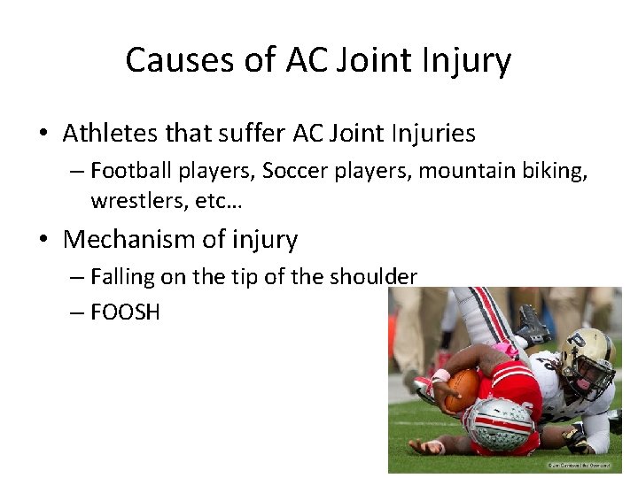 Causes of AC Joint Injury • Athletes that suffer AC Joint Injuries – Football