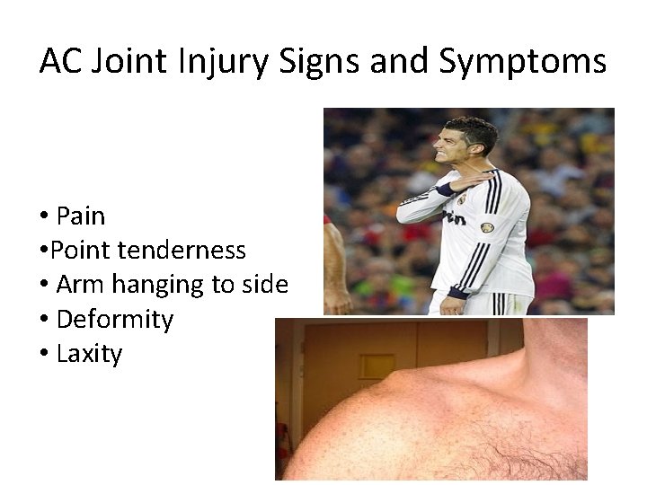 AC Joint Injury Signs and Symptoms • Pain • Point tenderness • Arm hanging