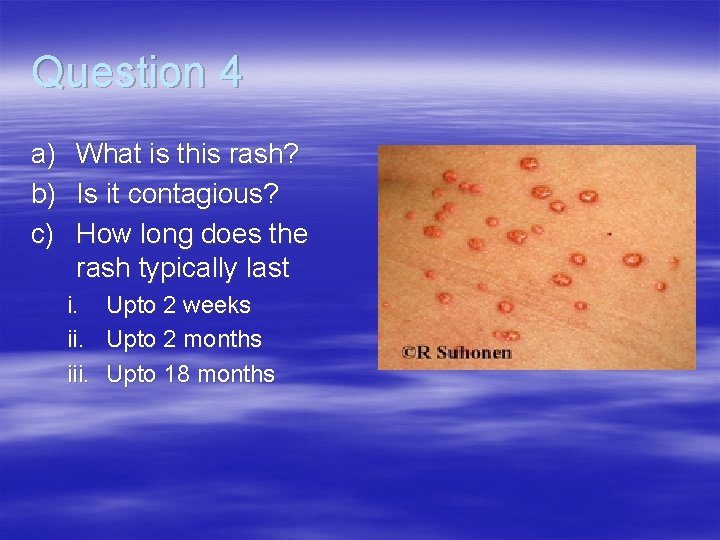 Question 4 a) b) c) What is this rash? Is it contagious? How long
