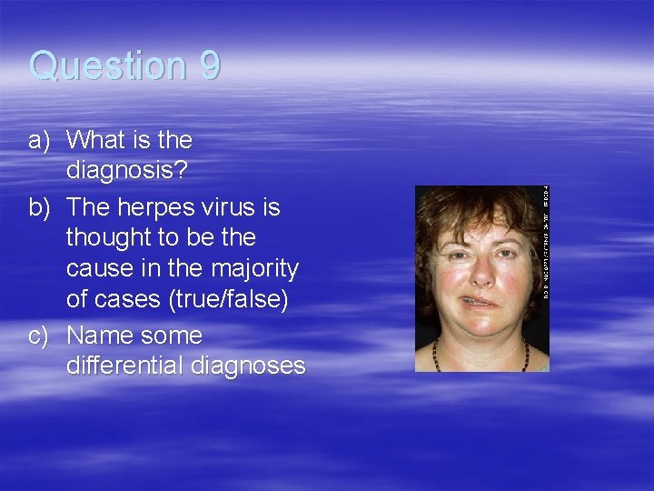 Question 9 a) What is the diagnosis? b) The herpes virus is thought to