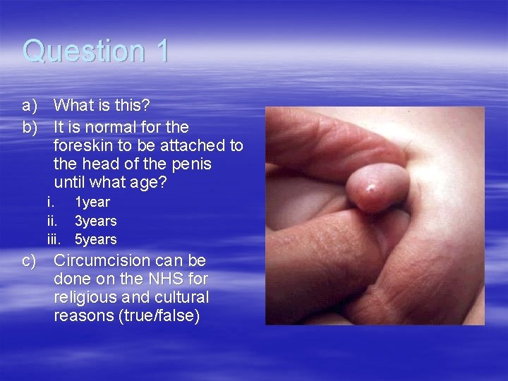 Question 1 a) What is this? b) It is normal for the foreskin to